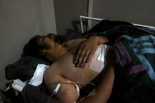Un blessé est soigné à dans une hôpital à Darat Izza dans la province d'Alep le 17 decembre 2023.
