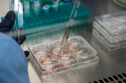 Un test est réalisé dans le laboratoire de la biotech française Transgene, Illkirch-Graffenstaden, en Alsace, le 17 novembre 2021
