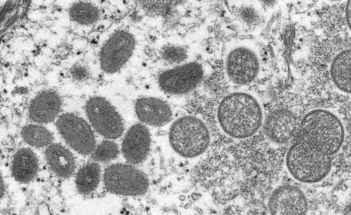Image issue d'un microscope électronique montrant un virion de variole du singe, obtenu d'un échantillon issu de l'épidémie chez des chiens de prairie en 2003
